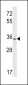 P2RY10 Antibody (Center)